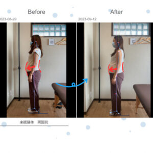 妊婦さんの姿勢の変化の写真。